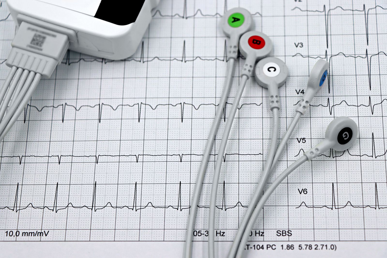 Cardiology Billing and the Codes That Trip Practices Up
